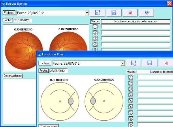 Módulo Oftalmológico: Biomicroscopía. Fondo de Ojo. Nervio Optico